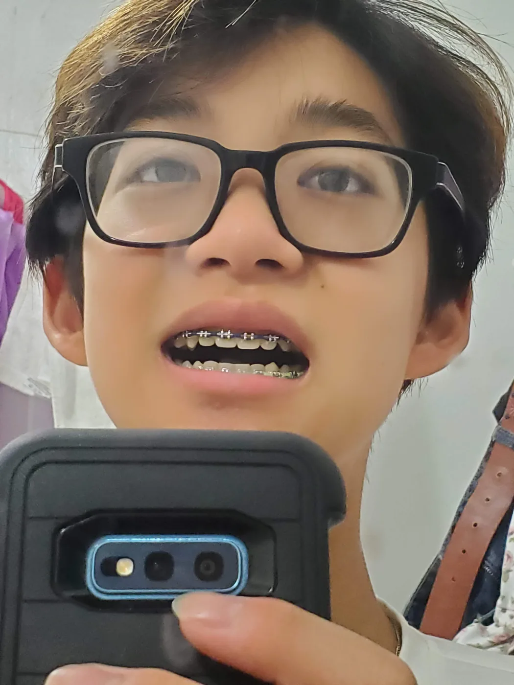 Close-up selfie of Aaron with braces and glasses